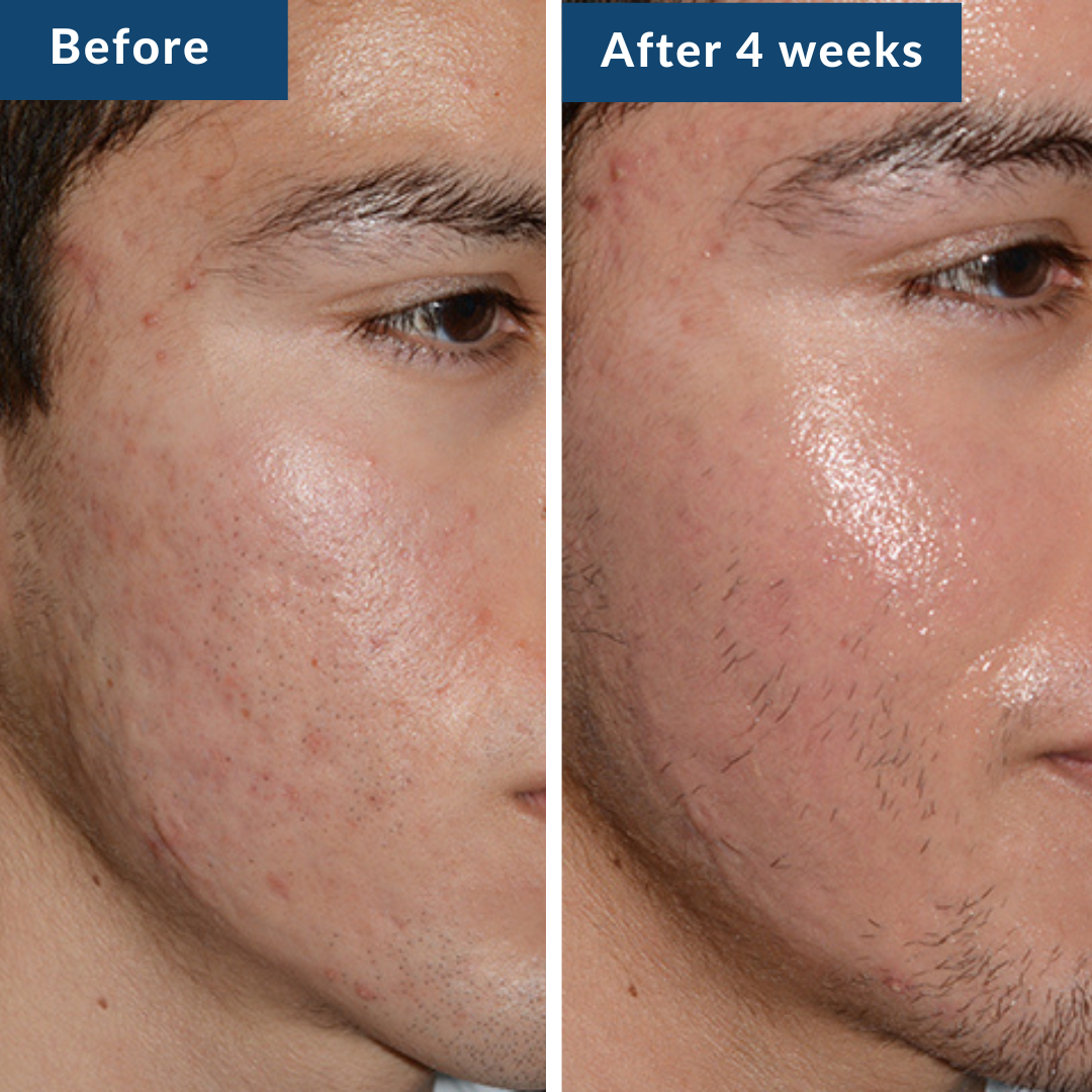 GHK-Cu Peptide Serum