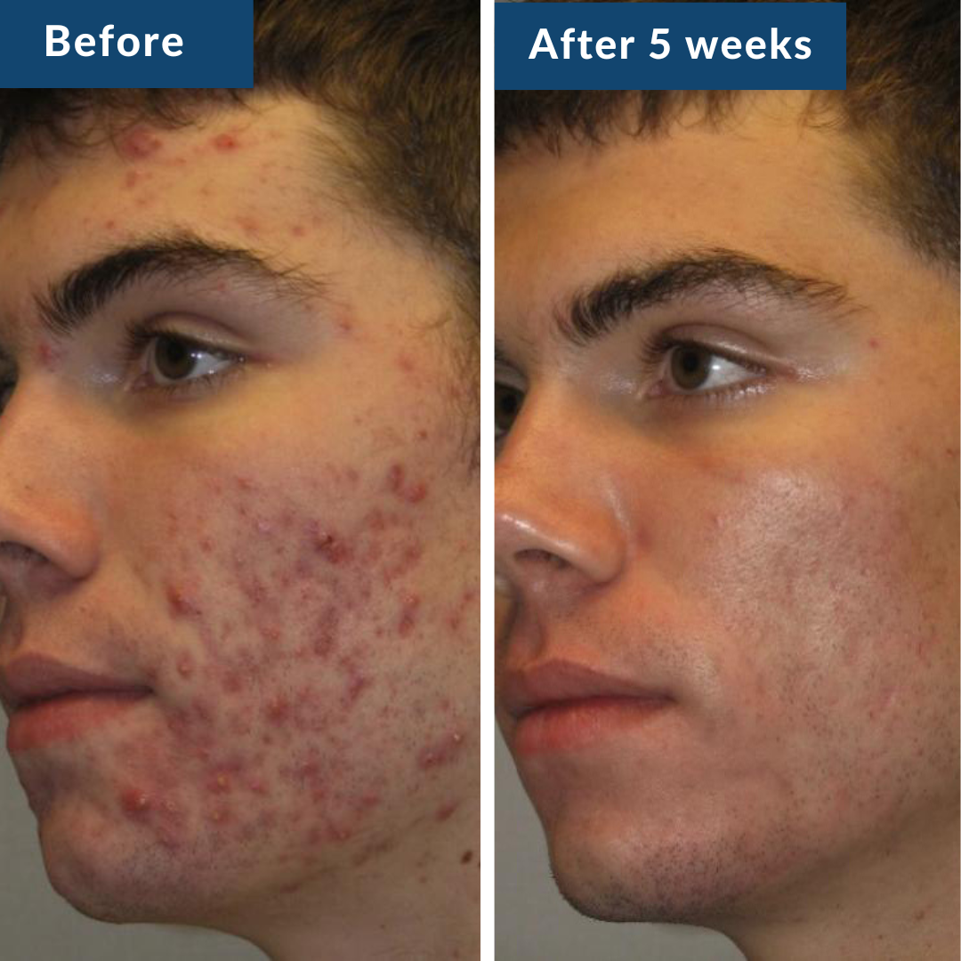 GHK-Cu Peptide Serum